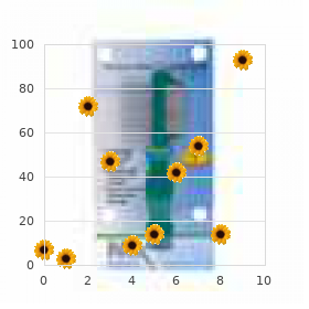 Benign fasciculation syndrome