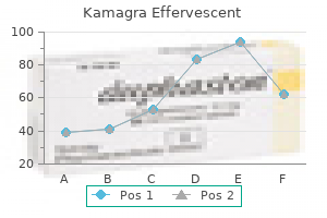 purchase 100 mg kamagra effervescent with mastercard