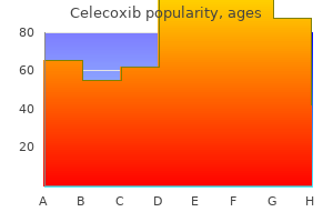 discount 200 mg celecoxib fast delivery