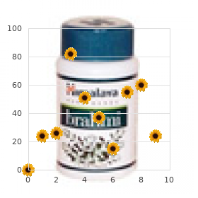 Brachydactyly clinodactyly