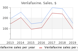 buy venlafaxine on line amex