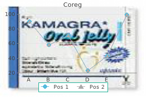 buy coreg 12.5mg amex