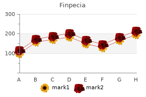 finpecia 1mg amex