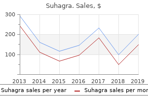 purchase suhagra 50 mg fast delivery