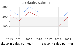 cheap skelaxin 400 mg with mastercard
