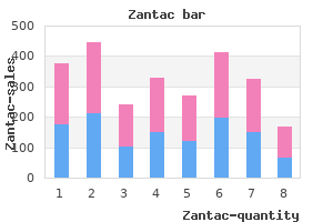buy zantac 150mg mastercard