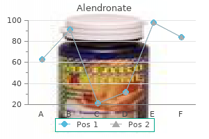 buy generic alendronate on line