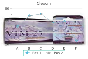 purchase cleocin 150 mg on-line