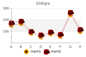 cheap sildigra generic