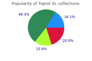 discount toprol xl 50 mg fast delivery