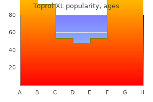 discount 25 mg toprol xl overnight delivery