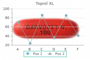 buy genuine toprol xl on line